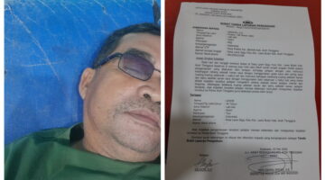 Wartawan di Aceh Tenggara Jadi Korban Penganiayaan, Pelaku Penyembelihan Ustad Didesak Segera Ditahan Polisi